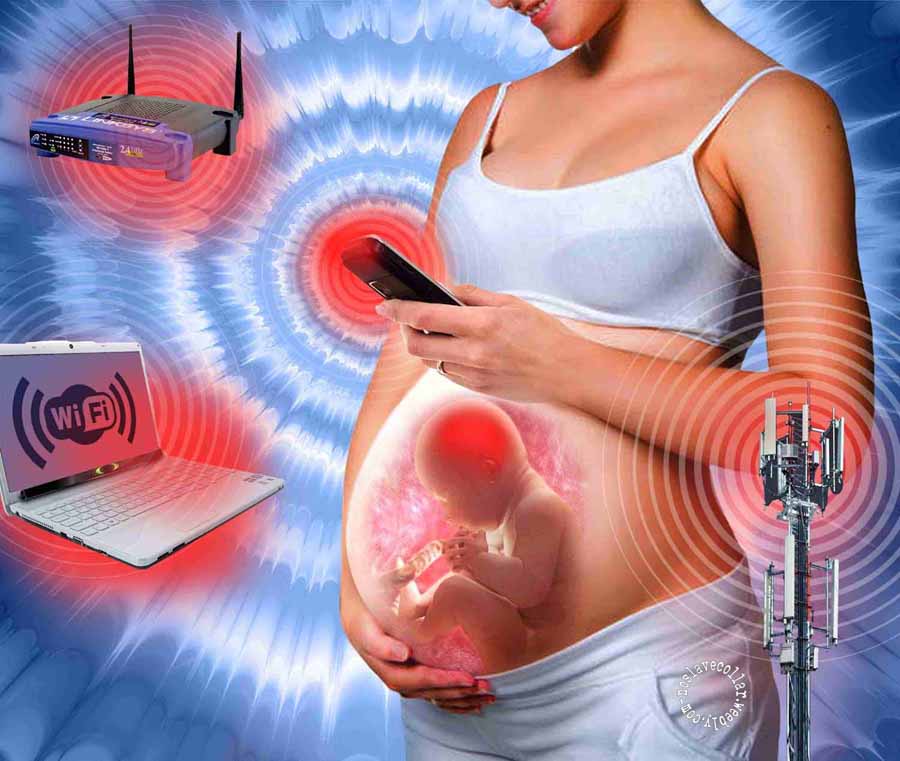 Irradiated pregnancy - work by David Dees